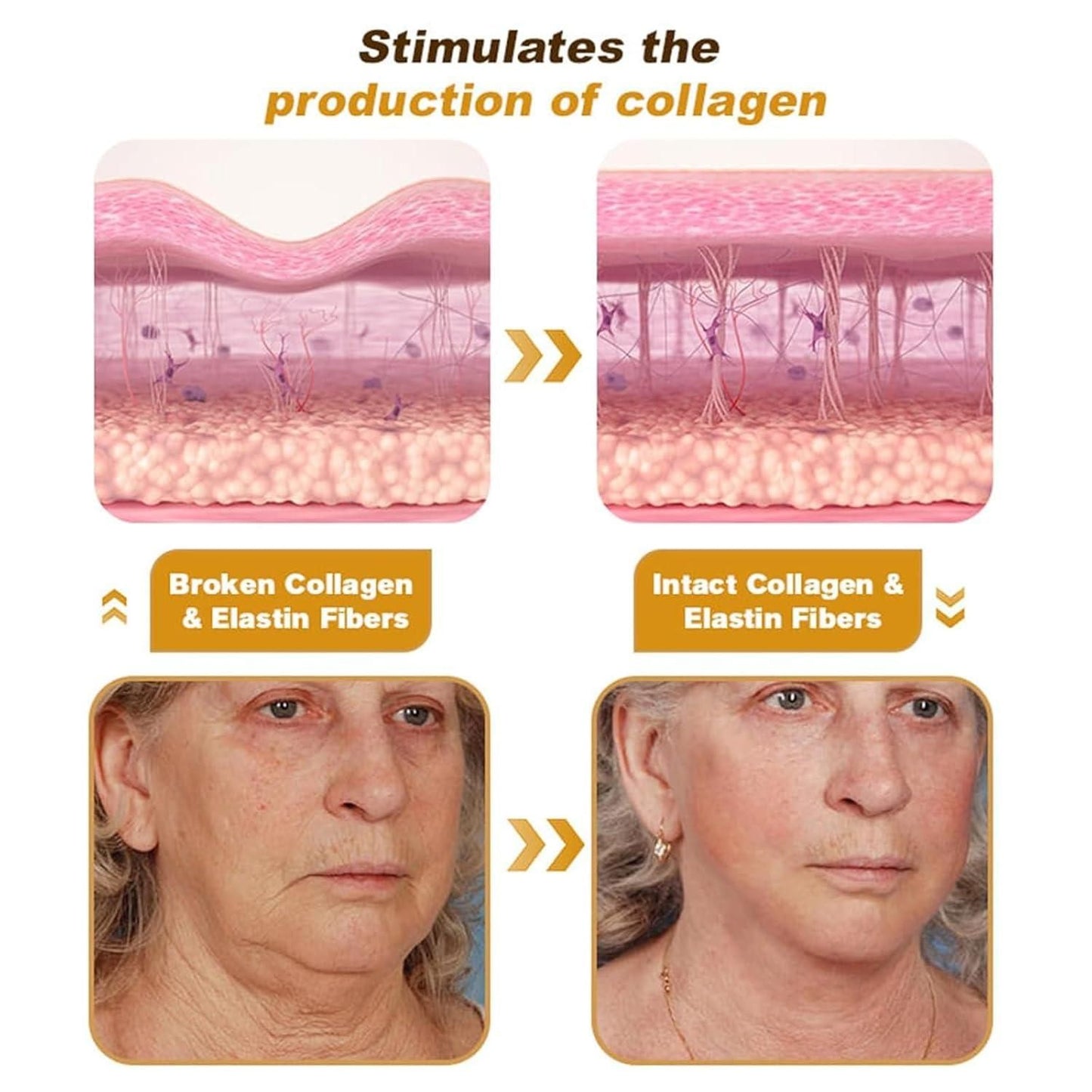 Botox Bee Venom Cream ( Buy 1 Get 1 Free)