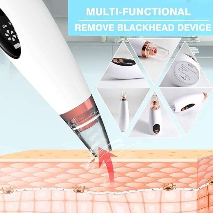 6 in 1 Multi-Function Blackhead Remover Tools