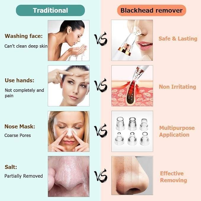 6 in 1 Multi-Function Blackhead Remover Tools