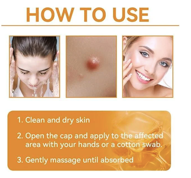 Bee Venom Skin Treatment Cream (Buy 1 Get 1)