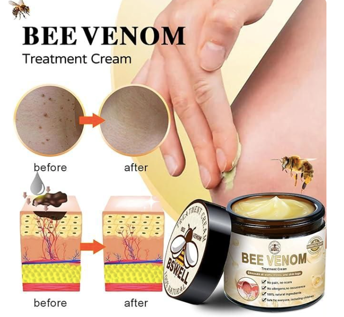 Bee Venom Skin Treatment Cream (Buy 1 Get 1)