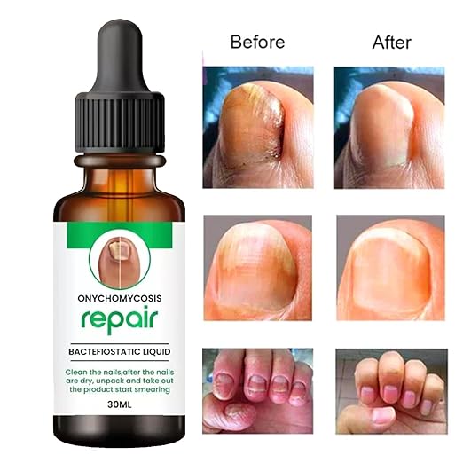 Nails Strong Growth And Repair Oli (Buy 1 Get 1 Free)