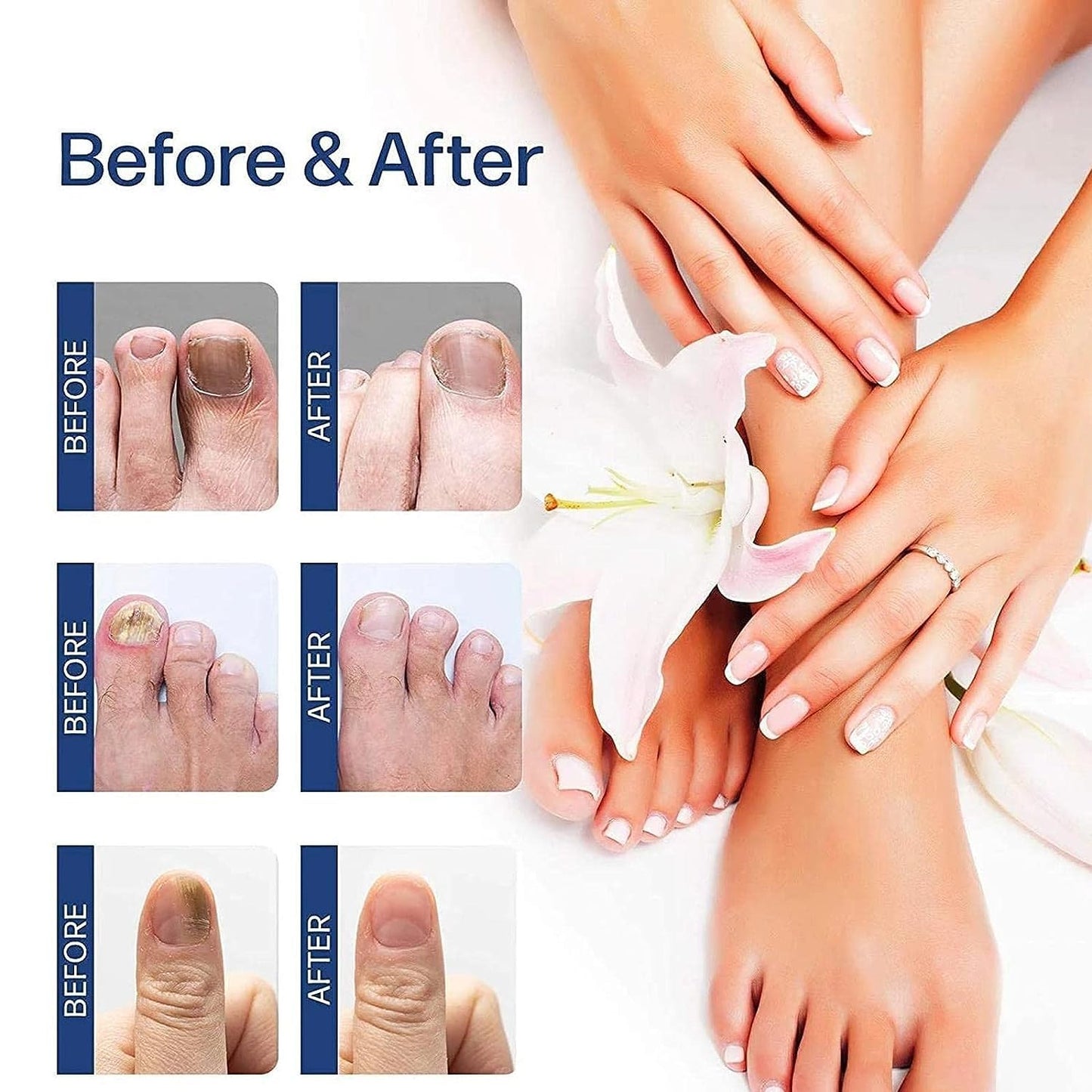 Nails Strong Growth And Repair Oli (Buy 1 Get 1 Free)